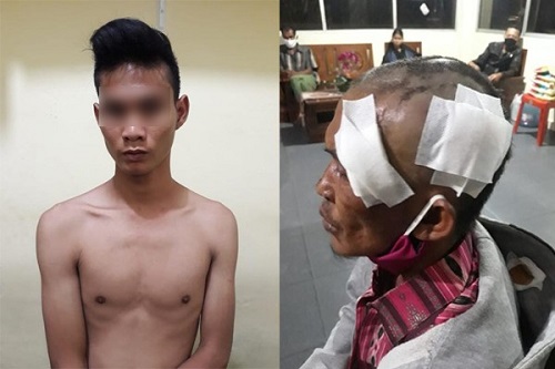 Marah Dibangunkan saat Tidur, Pria Ini Aniaya Ayah Tiri Hingga Tak Berdaya