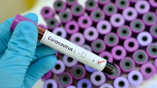 Korban Jiwa Akibat Virus Corona di China Bertambah Jadi 80 Orang