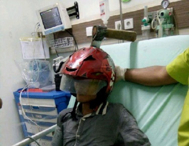 Mahasiswa Nyaris Tewas Dengan Kapak Menancap di Helm
