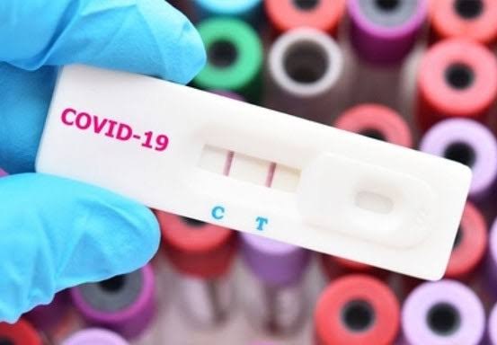 Antisipasi Nakes Terpapar Covid-19, Ahli Epidemiologi Riau akan Beri Pelatihan