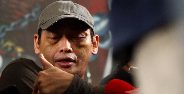 Diculik dan Dianiaya, Ninoy Karundeng: Saya Mau Dieksekusi Ala ISIS