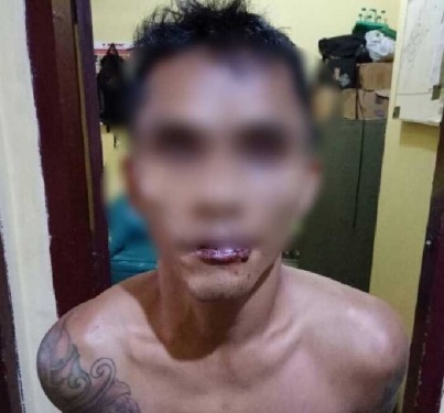 Jambret Kalung PNS Wanita, Residivis Bertato Dihajar Sampai Bonyok