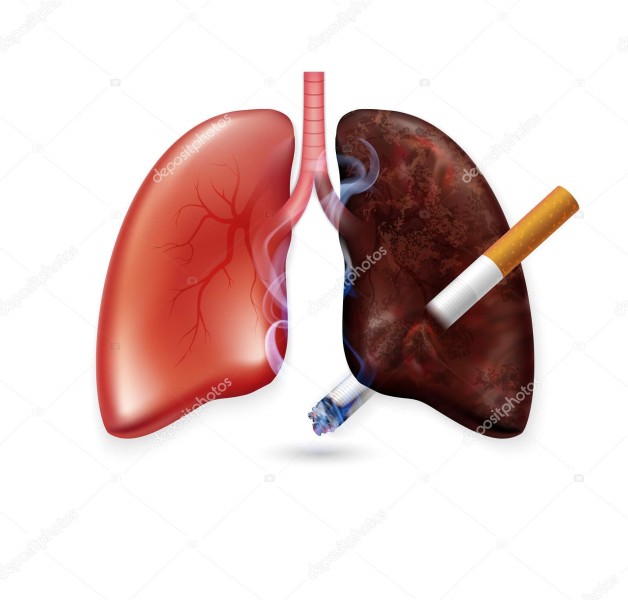 Diskes Pekanbaru Gencarkan Program Berhenti Merokok untuk Tekan Kasus Kanker Paru