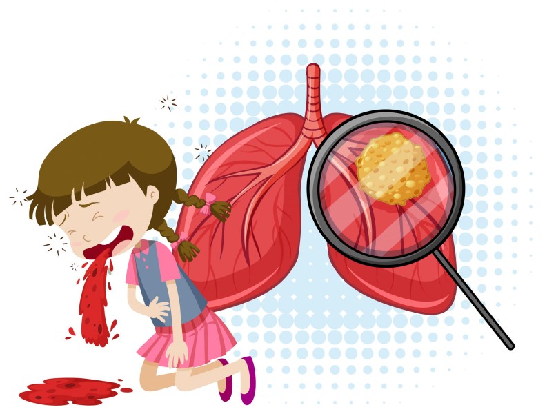 Waspada TBC, Dinkes Pekanbaru Lakukan Active Case Finding di Fasilitas Kesehatan