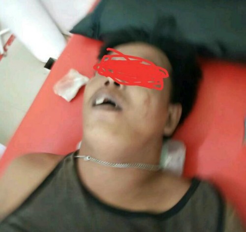 Telan Barang Bukti 4 Bungkus Sabu, Pengedar Narkoba di Pelalawan Tewas