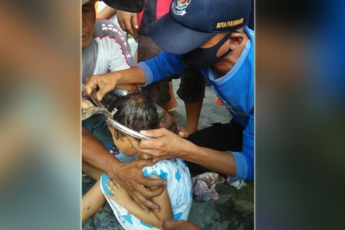 Waduh! Tutup Panci Tersangkut di Kepala Bocah di Pekanbaru