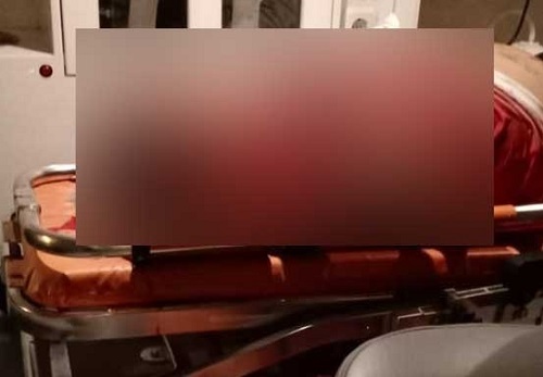 Tabrak Pot Bunga, Warga Alai Tebingtinggi Barat Meninggal di Tempat