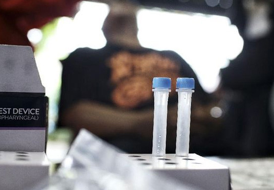 Ahli Duga Sebaran Corona Eek di RI Lebih dari yang Dilaporkan