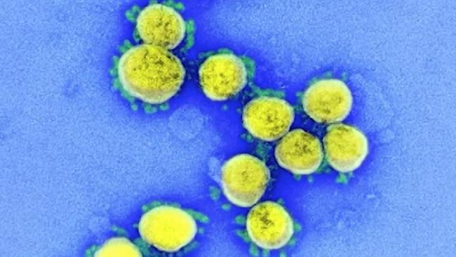 Ilmuwan Ungkap Sel di Dalam Tubuh yang Diserang Virus Corona