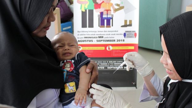 Kisah seorang ibu di Aceh yang anaknya alami rubella: 'Saya pikir panas biasa, tapi ternyata rubella