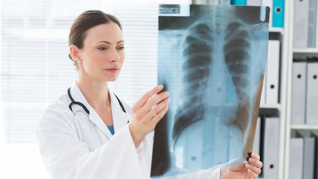8. Sakit tulang  kanker paru-paru juga bisa menyebar ke tulang di area punggung dan lainnya. Rasa sa