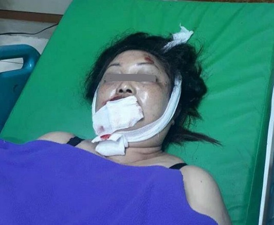 Terseret 12 Meter Saat Dijambret, Wanita di Pekanbaru ini Tewas