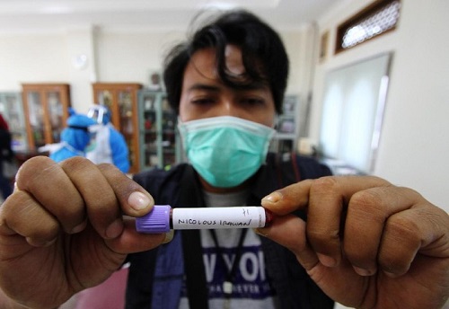 Mengenal Apa Itu Rapid Test, Biaya, dan Lokasi Tes COVID-19