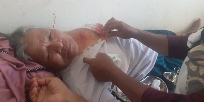 Polda Maluku soal 18 Warga Tertembak: Kalau Peluru Tajam Mungkin Tak Selamat