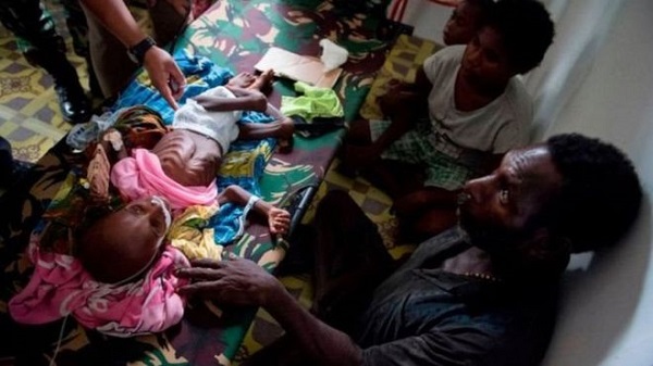 Kunjungi Indonesia, pelapor khusus PBB untuk hak atas pangan soroti kasus gizi buruk di Papua