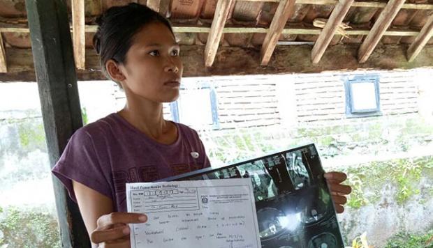 Sri Rabitah, TKW Indonesia yang Kehilangan Satu Ginjal di Qatar