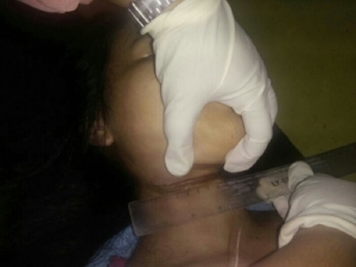 Pelajar SMK Nekat Mengakhiri Hidupnya Dengan Gantung Diri